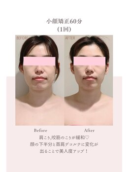 トゥインクル 麻布(twinkle)/港区/麻布十番/小顔矯正/肩こり