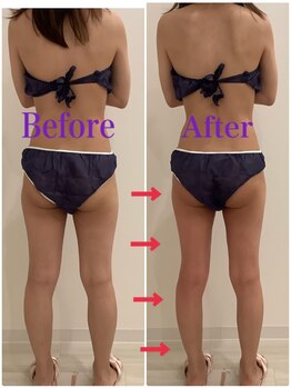 スペチアーレ 夙川/浮腫みや冷え性とサヨナラ