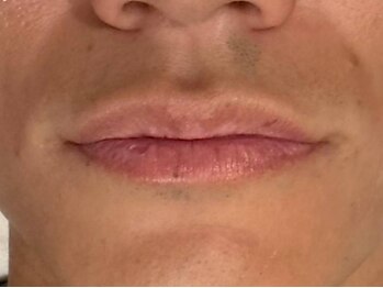 ウィルビー(will vi)の写真/金沢八景ならここ！通いやすさが魅力◎横浜最低水準価格でのご提供！最新マシンで速攻脱毛卒業も◎