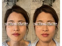 ハリトト鍼灸院の雰囲気(大人気な美容鍼灸◎小顔/リフトアップ/美肌ケア/むくみ解消)