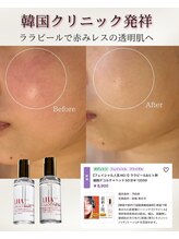 ユフラ(Juhla)/ララピール