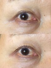 ダーム ド ローズ(Dame de rose)/【まぶたが上がるまつ毛パーマ】