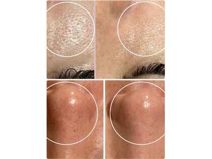 東京美肌管理サロン 六本木店の写真