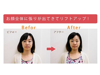 美容整体すこやか/BeforeーAfter