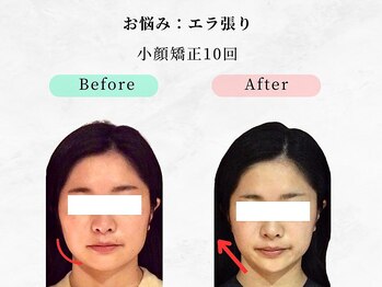 ウェリナ平和堂長久手院/小顔矯正/骨盤矯正/痩身/整体