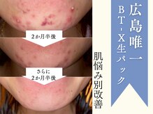 モルティー 広島店(Molti)の雰囲気（MOLTIでしか味わえない--お肌の根本改善を目指す◎生BT-Xパック）
