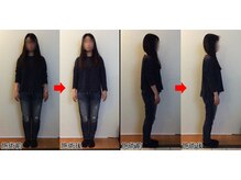 整体院プラス/全身スタイル矯正モニター
