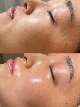 エユージュ(eyuge)/