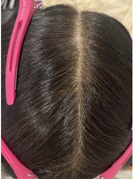 ビューティー アディクト(Beauty addict)/効果抜群！頭皮ケア