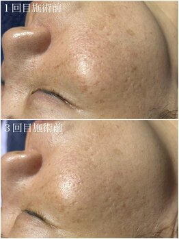 エステルーム クリスタル/【NEW】プラズマニア