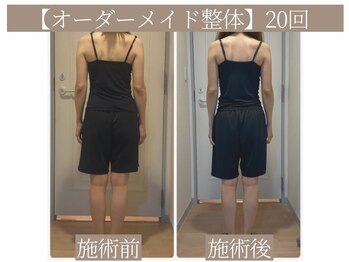 ドクターボディ 恵比寿店(Dr.Body)/【身体・顔の歪み/骨盤矯正】