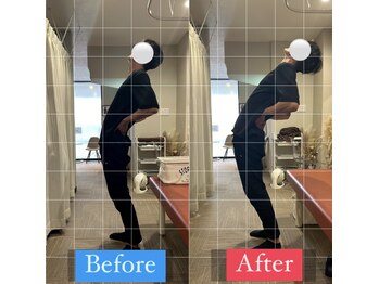 ナオル整体 宮崎院(NAORU整体)/20代男性施術事例【腰痛改善】