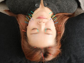 リム(Rim.)/オーダーメイド美容鍼