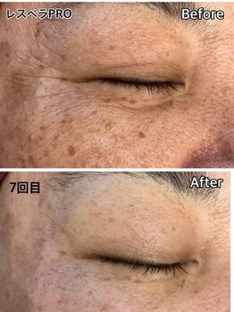 ベルミーランド イオン長浦/