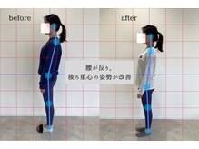 チューン(Tune)/20代　女性　月4回コース