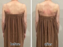 ロココ 四日市店(Rococo)/肩甲骨から変えていきます！