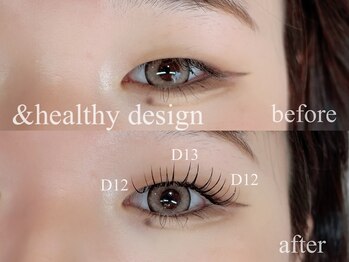 ユーロ(EURO)/&healthy(アンドヘルシー)