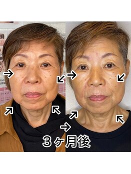 プレシャスワン 越谷店/72歳でも実感!