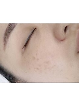 定額/月額メニューのあるサロン