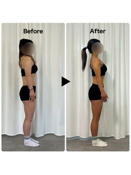 ノグジム(NOGGYM)/40代女性 ビフォーアフター