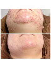 ビューティーホリック 蘇我店(BEAUTY HOLIC)/