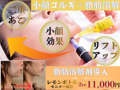 カリスティ(CHARIS.T)の写真