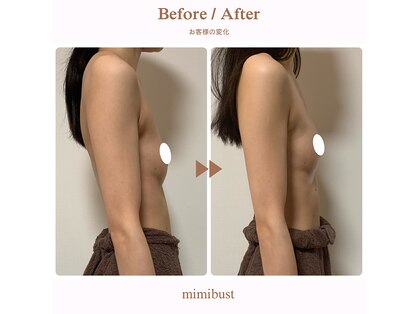 ミミバスト(mimibust)の写真