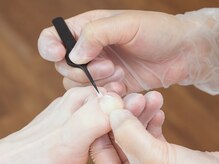 ペディケア 横浜本店/オプション：巻爪ケアBSスパンゲ