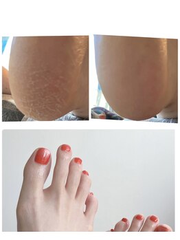 マルソ(marco)/足裏ケア+ジェルネイル☆オフ込