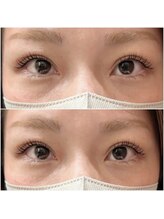 グリッターネイル(GLITTER NAILS)/セラムラッシュリフト