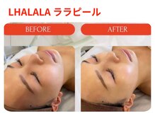 アンピュール(an pur)/ララピール　1回でツヤ肌