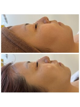 ミャオ(Meow!)/エアバリ