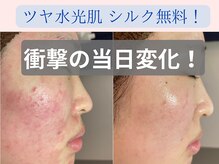 エヌエースキン(NAskin)の雰囲気（ニキビケア、毛穴ケア実績多数！症例写真はフォトギャラリーへ！）