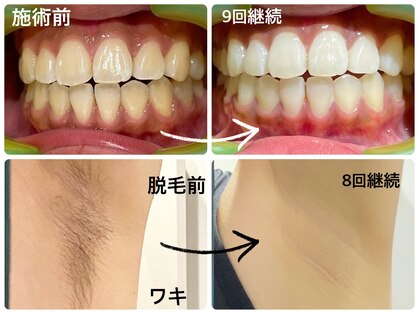 ワイズサロン(Y's salon)の写真