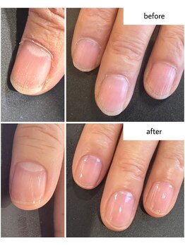 ケアプラス(care plus)/ハンドネイルケア