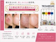 オーリス(Aurise)