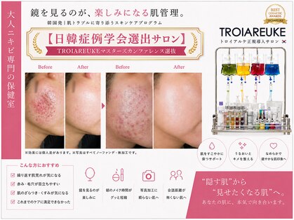 オーリス(Aurise)の写真