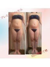 ゲットレディー マイ スリムレディー/プレミアムslimセル１回