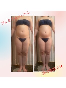 ゲットレディー マイ スリムレディー/プレミアムslimセル１回