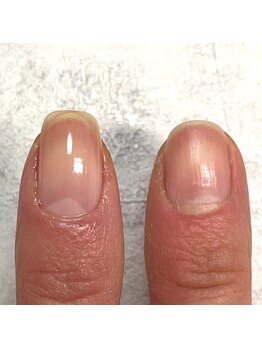 美爪育成ケアしたのはどっち？