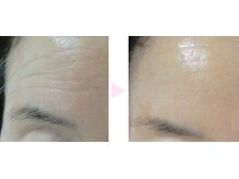 ノンノン(NonNon)/若々しい見た目へ