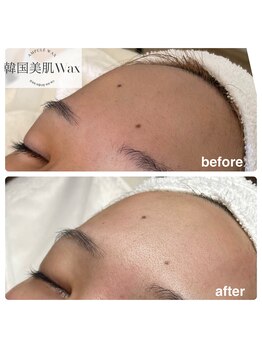 ティアム(Tiam)/韓国美肌wax