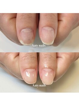 アーティネイルズ(Aaty Nails)/剥離、トラブル爪もご相談下さい