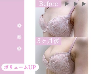 キアナ 横浜店(Kiana)/バストアップBefore After