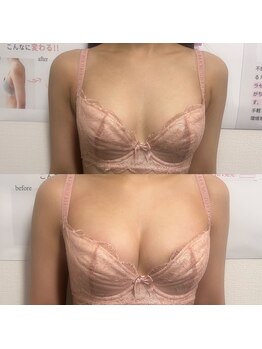 ジュエルリング(Jewel Ring)/バストアップ【恵比寿代官山】