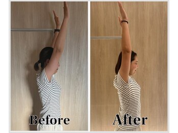 整体ラルース 中目黒(LALUZ)/20代 女性 肩こり、巻き肩改善