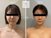 ヤエシーファイブクリニック(YAE C5 CLINIC)の雰囲気（札幌エステ/大通/桑園/フェイシャル/小顔/痩身/耳ツボジュエリー）