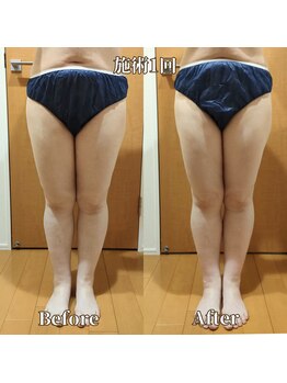 ヨサパーク サーナ 仙川(YOSA PARK Sana)/50代お客様ビフォー⇒アフター