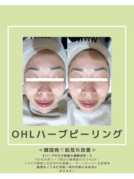 ソワナ(soina)/【神楽坂駅/フェイシャル/毛穴】