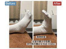 アンティオール 札幌店/40代男性　足首の痛み